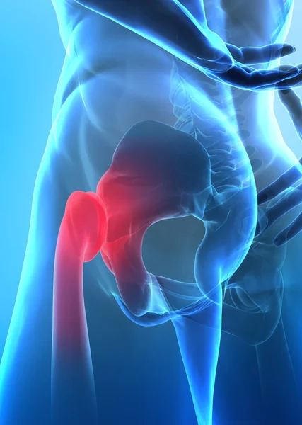 depositphotos_13280105-stock-photo-pain-in-hip-concept